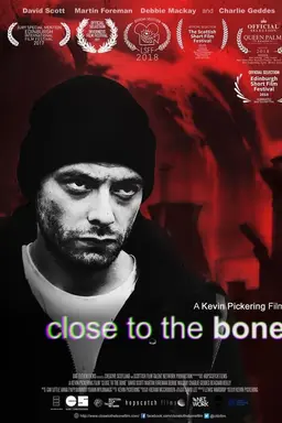 Close to the Bone