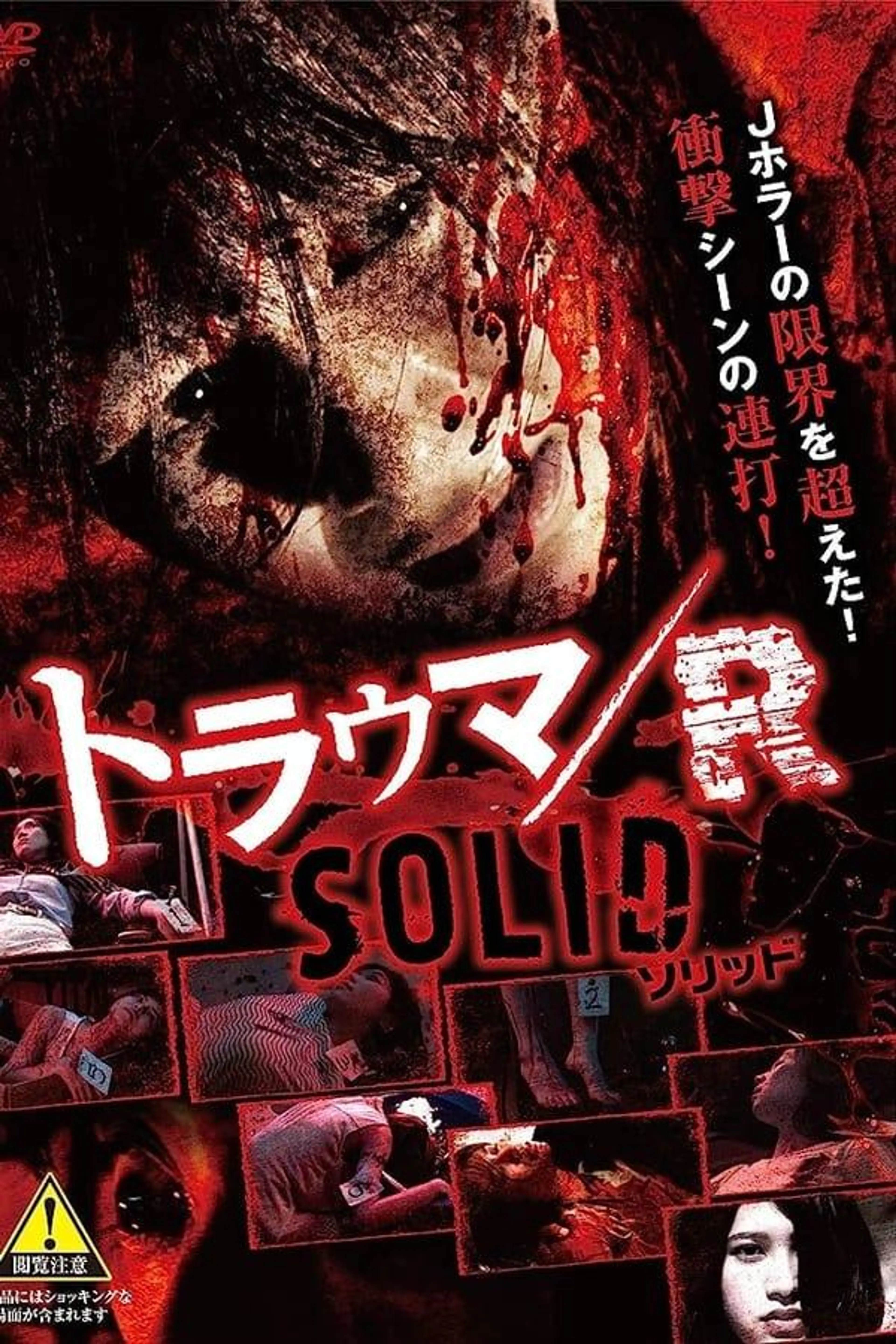 Trauma/R SOLID
