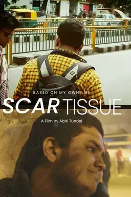 Scar Tissue