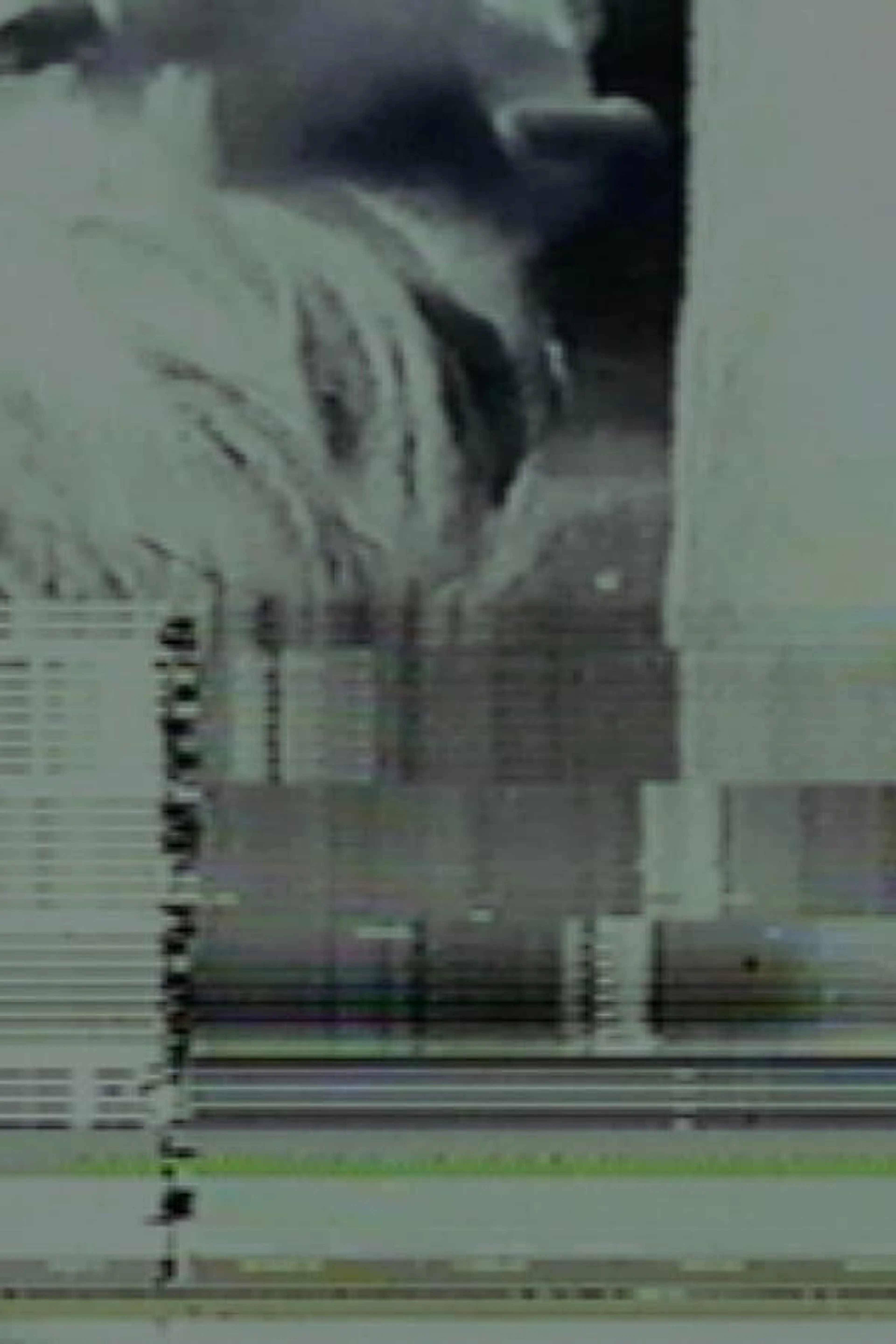 Static Discharge for Bleeding Eyes