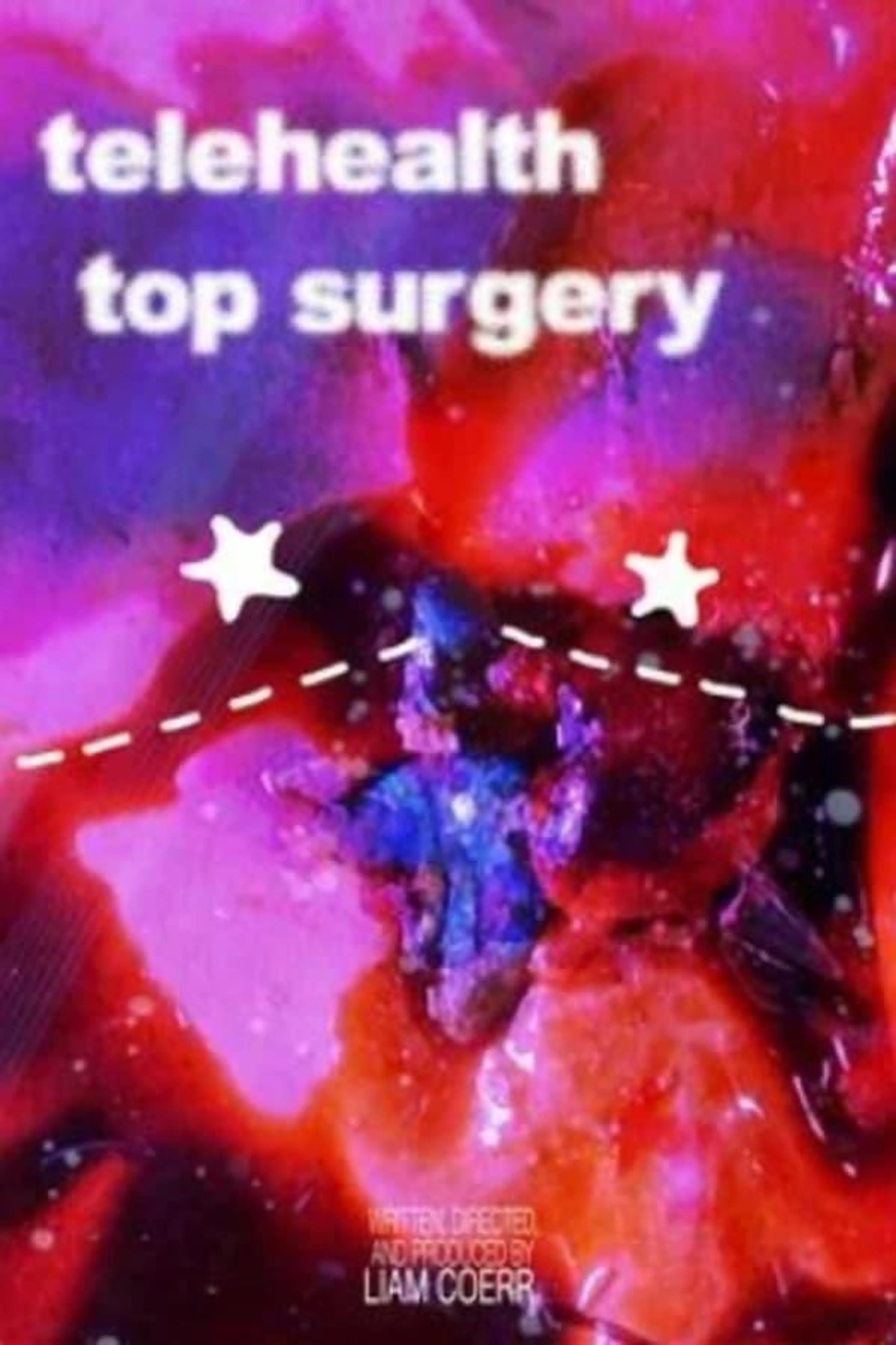 telehealth top surgery