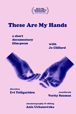 These Are My Hands