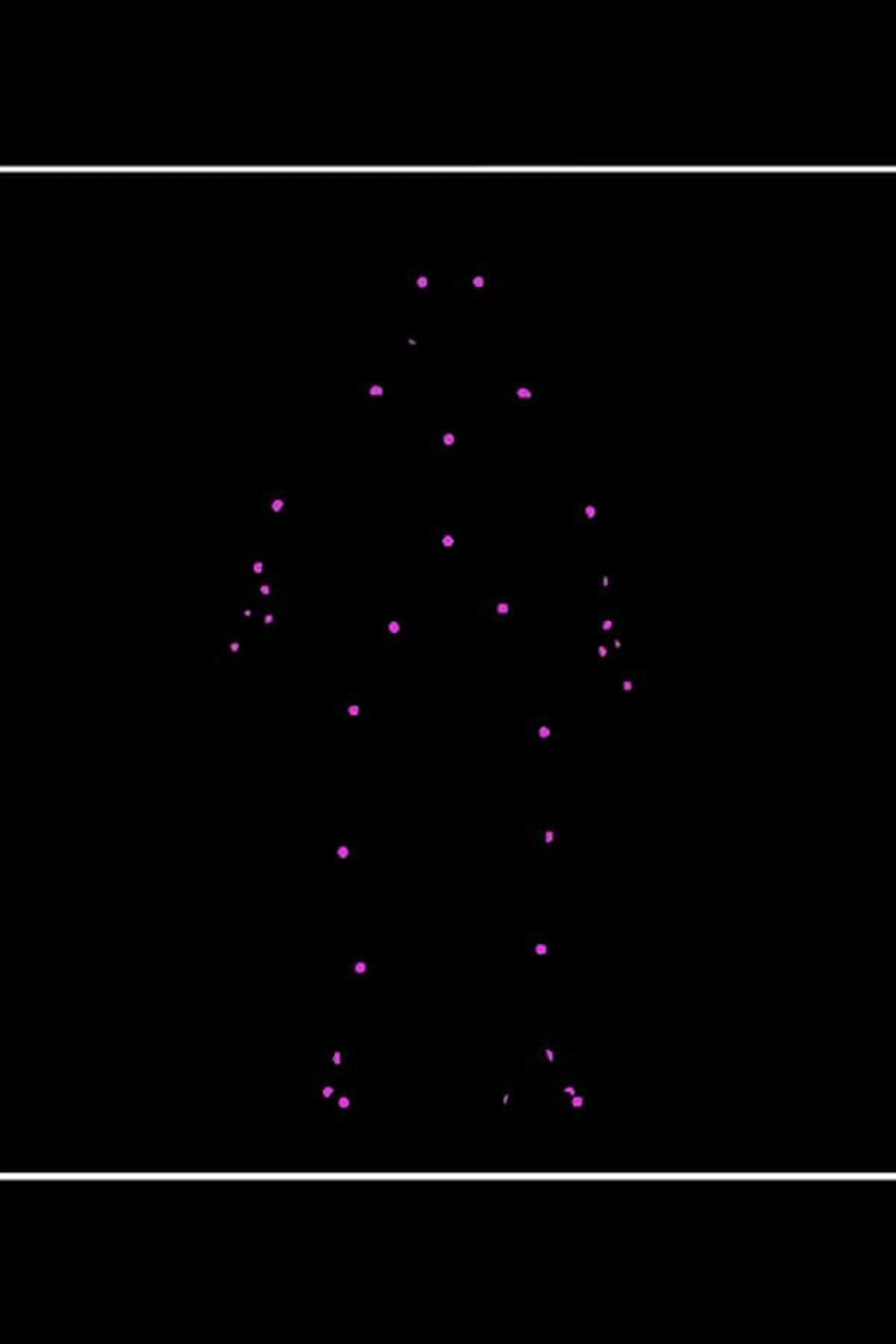 Network Reconstruction Of Nematode Symbionts