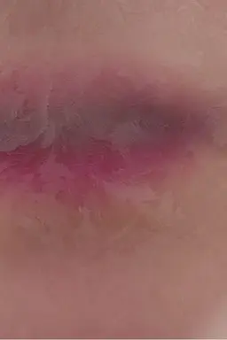 of white