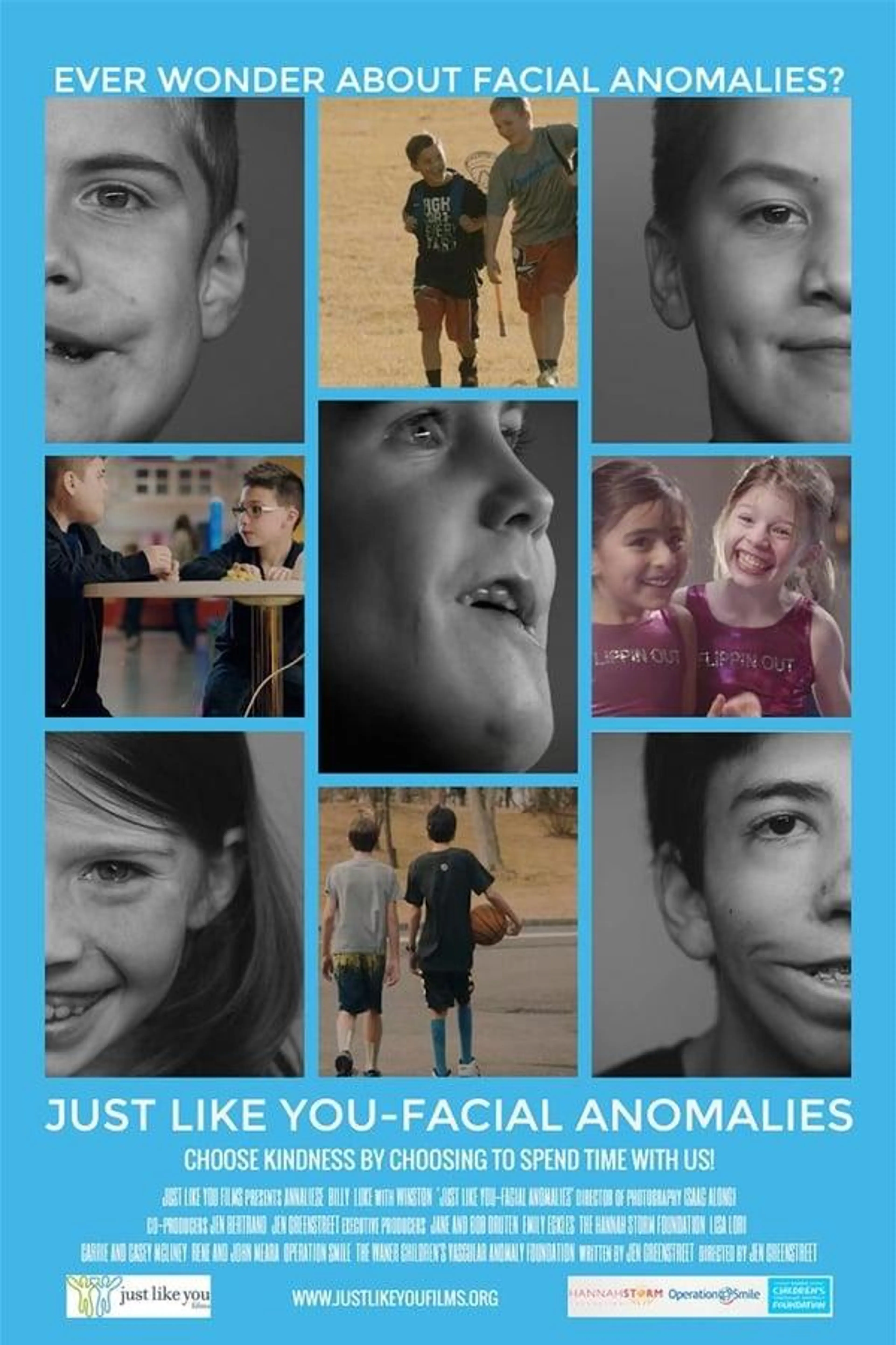 Just Like You: Facial Anomalies