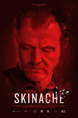 Skinache