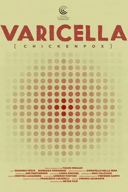 Varicella