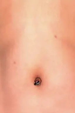 Moscas