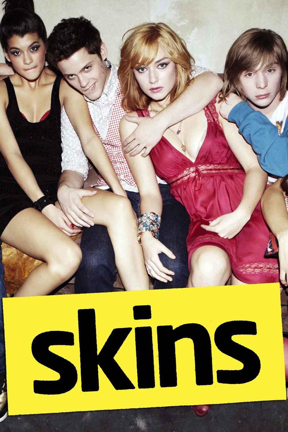 스킨스