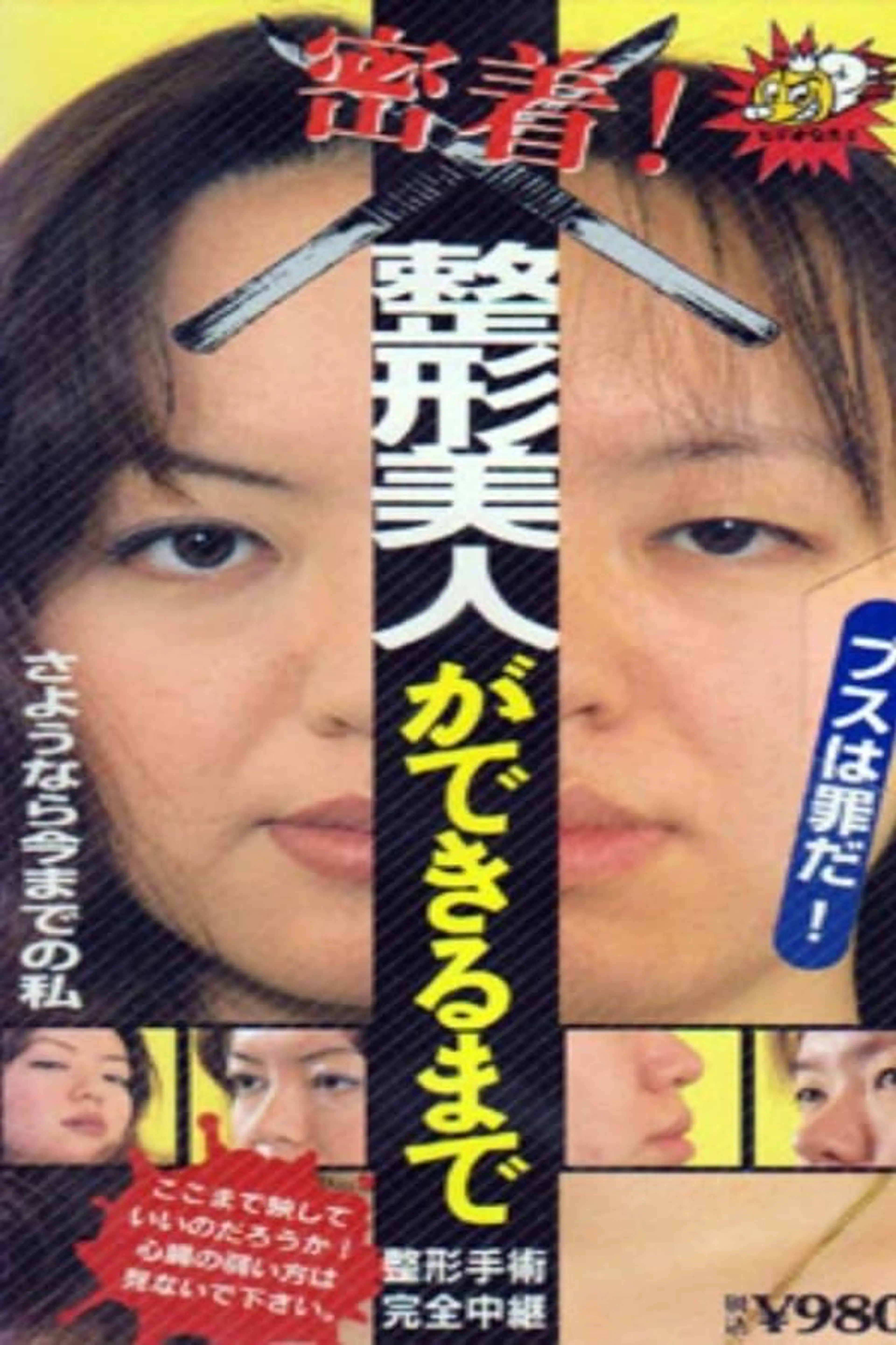 Until You Have  Beauty: Plastic Surgery