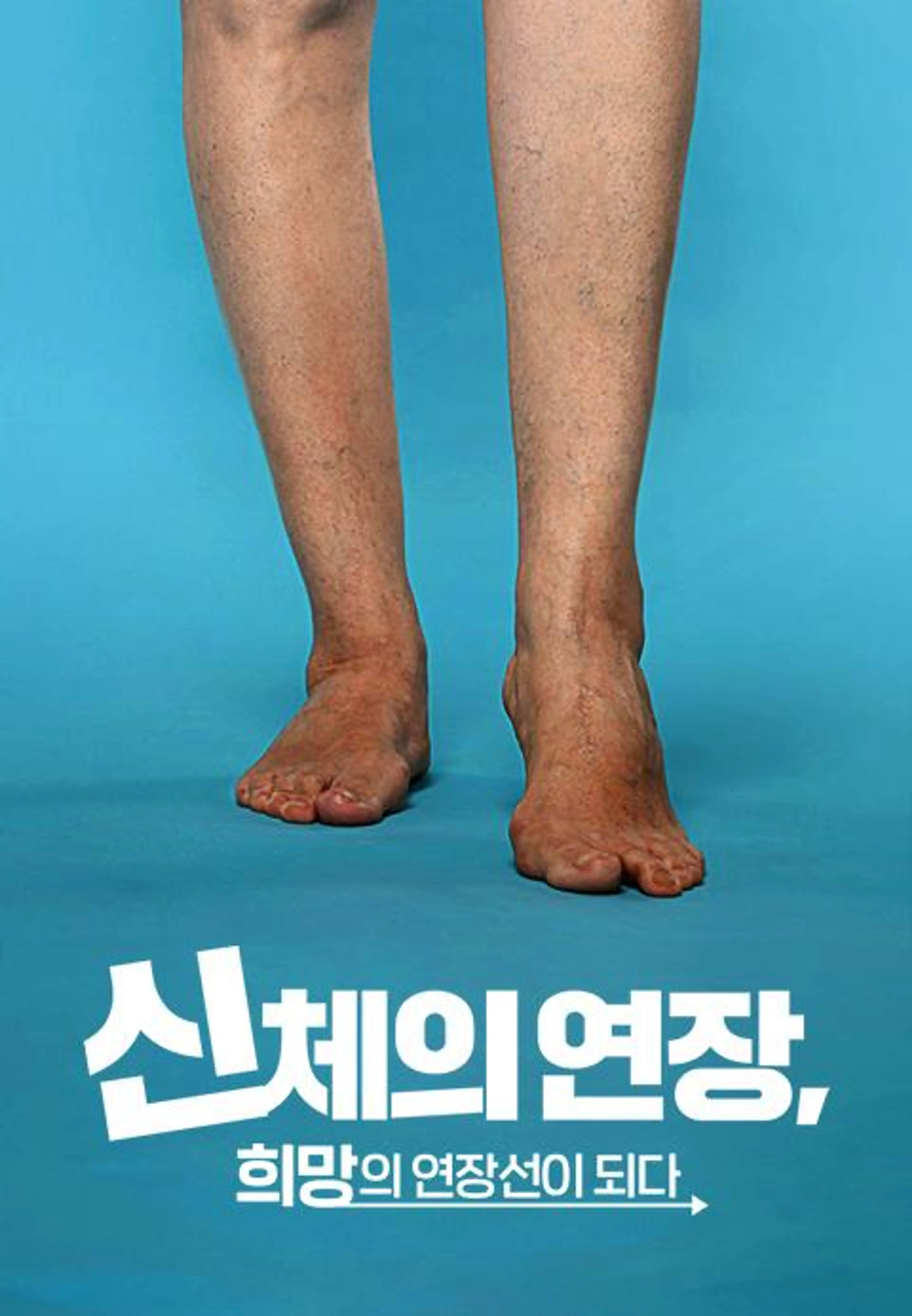 신체의 연장, 희망의 연장선이 되다
